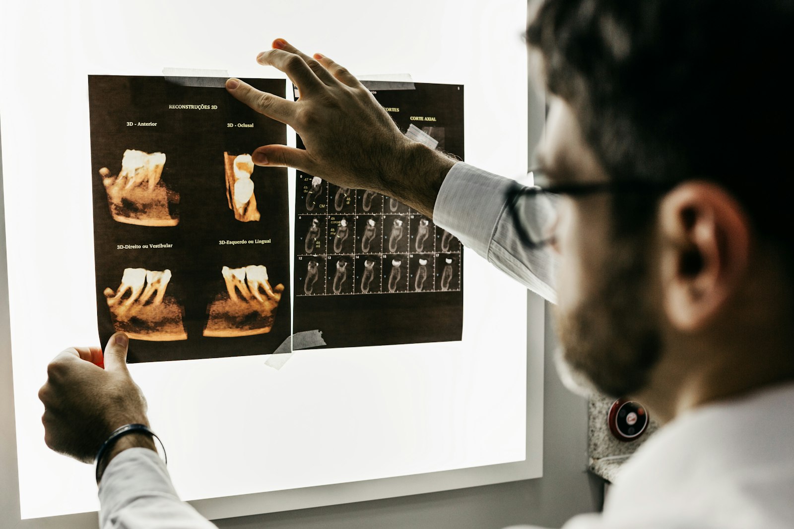 Our dentist reviewing digital X-rays with a patient